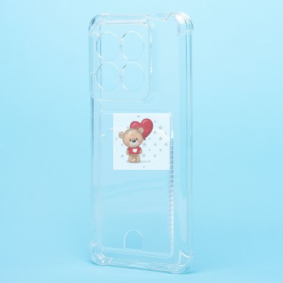 Чехол-накладка для Xiaomi 14 Pro (прозрачный) - SC276 с картхолдером