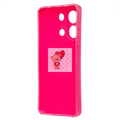 Чехол-накладка для Xiaomi Redmi Note 13 4G (розовый) - SC328