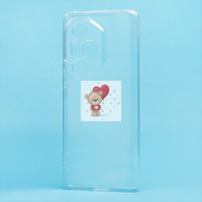 Чехол-накладка для Honor 300 Pro/Honor 300 Ultra (прозрачный) - Ultra Slim