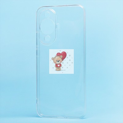 Чехол-накладка для Huawei nova 11 (прозрачный) - Ultra Slim Чехол-накладка для Huawei nova 11 (прозрачный) - Ultra Slim