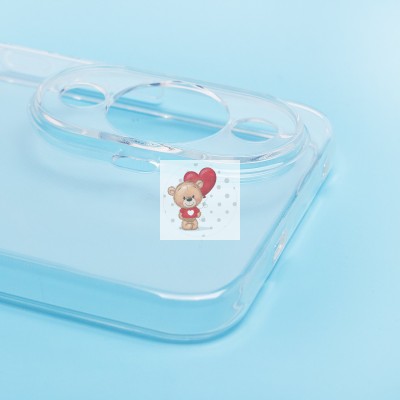 Чехол-накладка для Huawei nova 11 (прозрачный) - Ultra Slim Чехол-накладка для Huawei nova 11 (прозрачный) - Ultra Slim