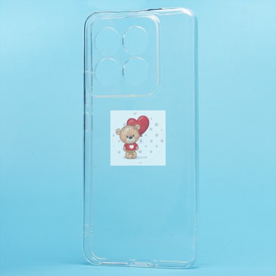 Чехол-накладка для Xiaomi 14 Pro (прозрачный) - Ultra Slim Чехол-накладка для Xiaomi 14 Pro (прозрачный) - Ultra Slim