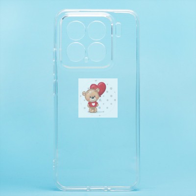 Чехол-накладка для Xiaomi 15 (прозрачный) - Ultra Slim