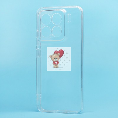 Чехол-накладка для Xiaomi 15 (прозрачный) - Ultra Slim Чехол-накладка для Xiaomi 15 (прозрачный) - Ultra Slim