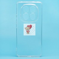 Чехол-накладка для Xiaomi Redmi Note 14 Pro 5G Global (прозрачный) - Ultra Slim