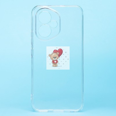 Чехол-накладка для Huawei Honor 400 Global (прозрачный) Ultra Slim Чехол-накладка для Huawei Honor 400 Global (прозрачный) Ultra Slim